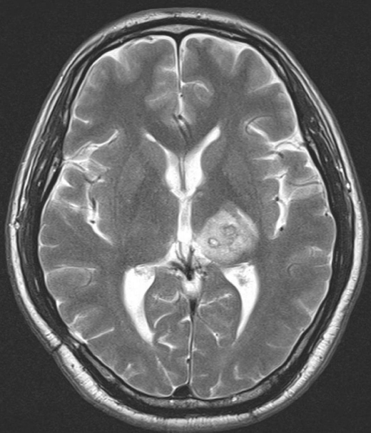 Bran-Scan 1.j